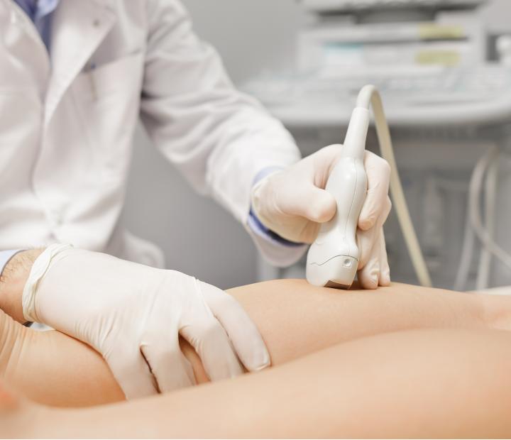 Cuando las piernas hablan, ¡Escucha tu circulación!