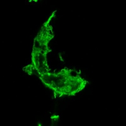 UTILIZACIÓN DE CÉLULAS DENDRÍTICAS PARA EL TRANSPORTE DE NANOPARTÍCULAS AL TUMOR