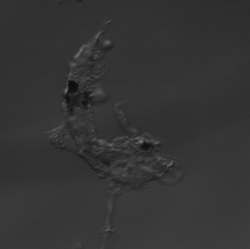 UTILIZACIÓN DE CÉLULAS DENDRÍTICAS PARA EL TRANSPORTE DE NANOPARTÍCULAS AL TUMOR